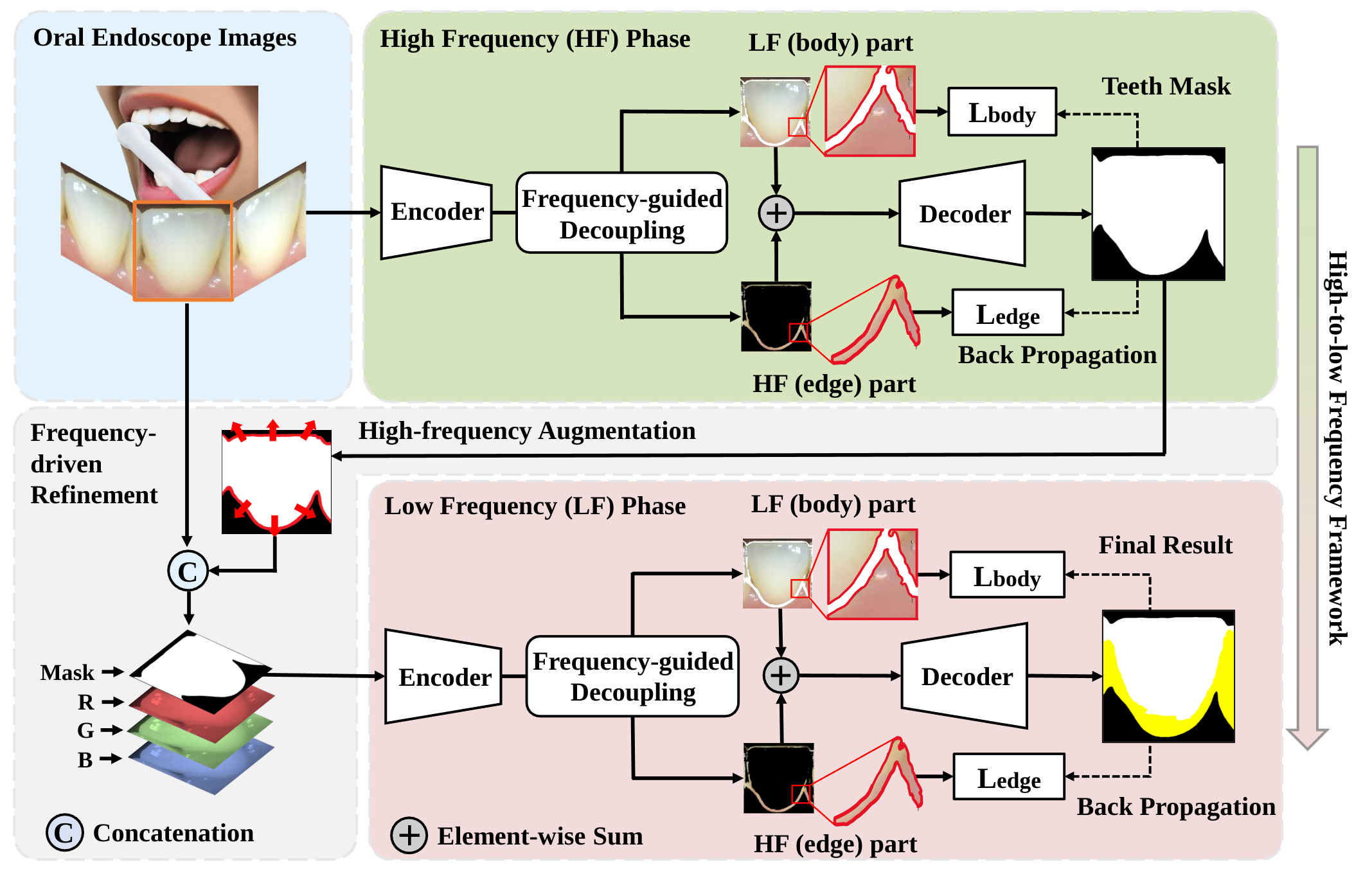 The Frequency-Guided Network pipeline for dental plaque segmentation